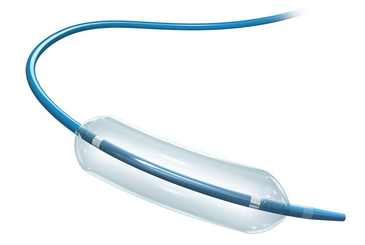 Balloon Dialation Catheter