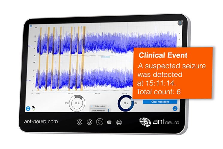 Simplified Cerebral Function Monitoring System with Standard Accessories